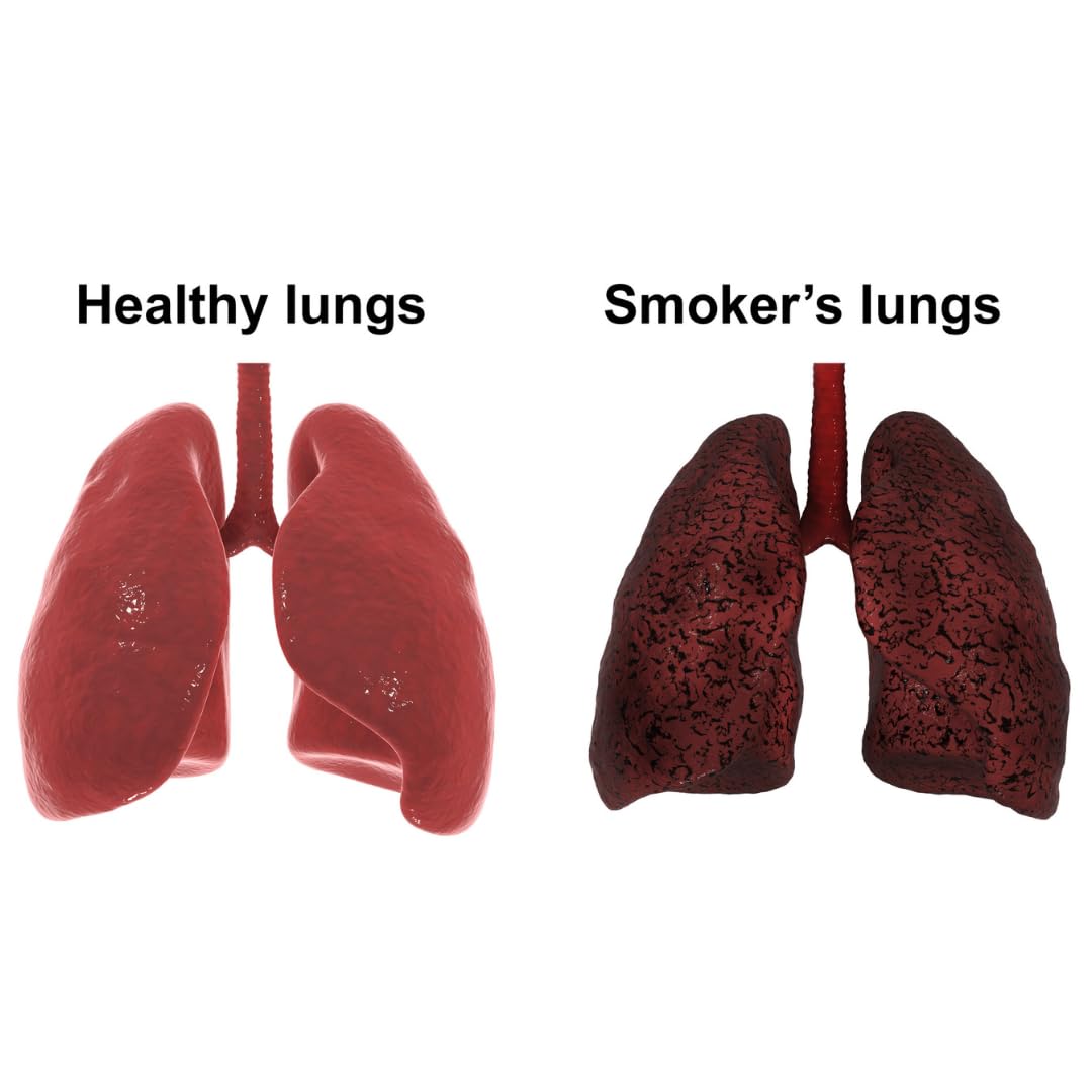 Rootcare Organics Lung Cleanse Tea - 100 gms
